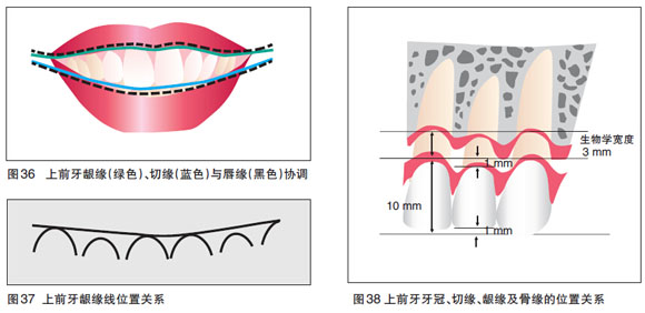 牙冠延長術(shù)適合哪些情況